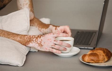 La maladie de la gaufre bleue est